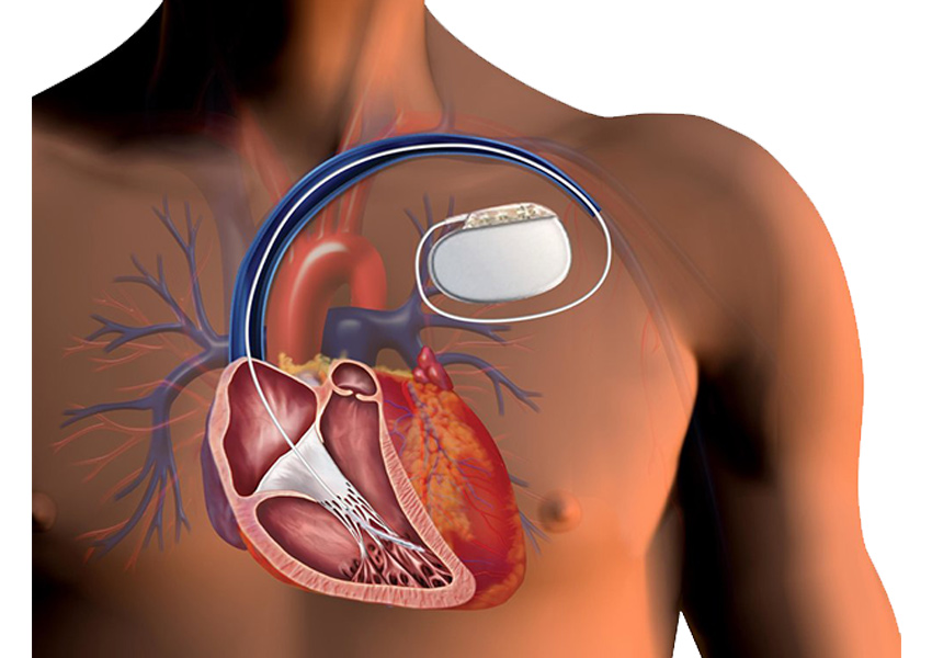 Heart care